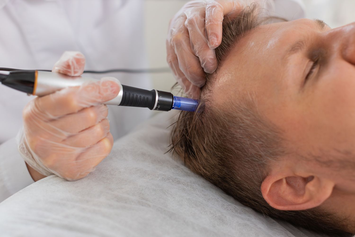 Hair Restoration